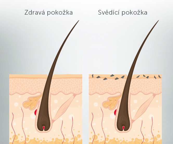 Jak funguje svědění?